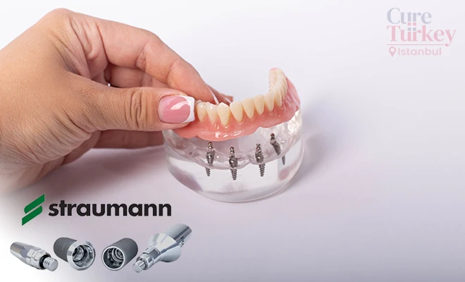 Implanturi Straumann: Calitatea Elvețiană pentru Zâmbetul Tău Durabil – Dr. Marius Mahalianu